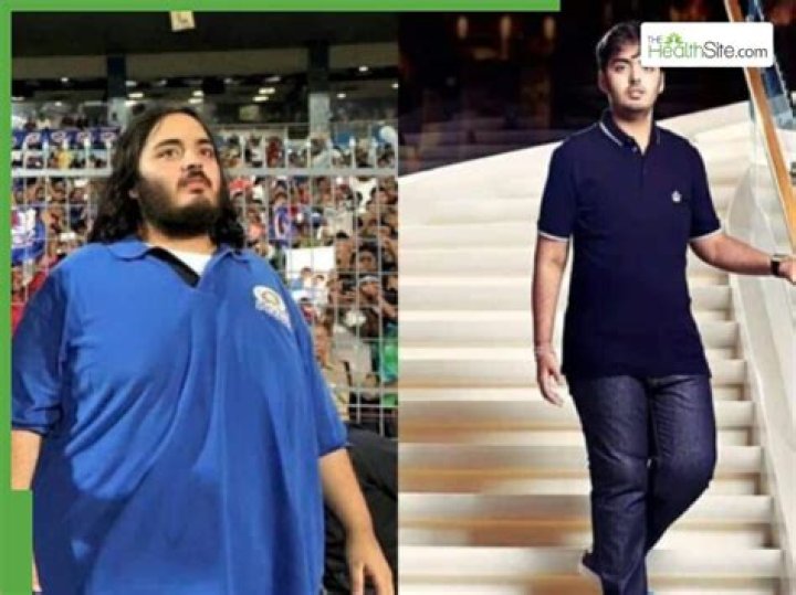 Anant Ambani's Journey To Transformation: The Fat Surgery Story