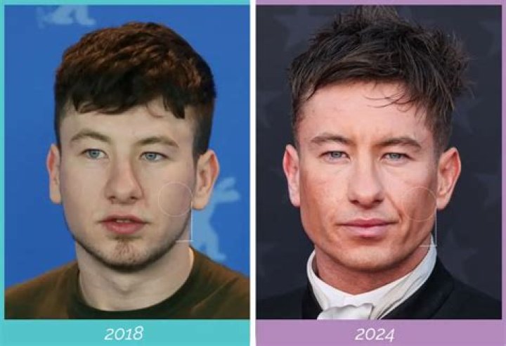 Barry Keoghan: Unraveling His Ethnicity And Asian Roots