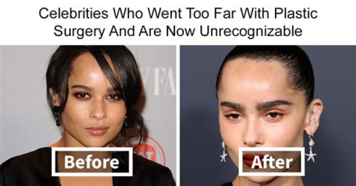 Behind The Camera: News Anchors Who Have Had Plastic Surgery