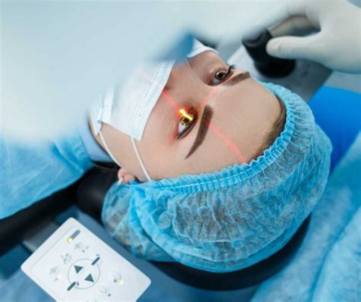 Everything You Need To Know About Having LASIK Eye Surgery Twice