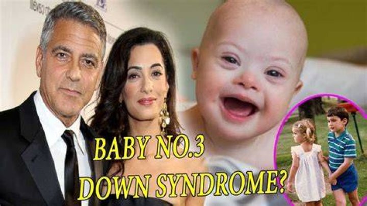 Is One Of George Clooney's Twins Born With Down Syndrome?