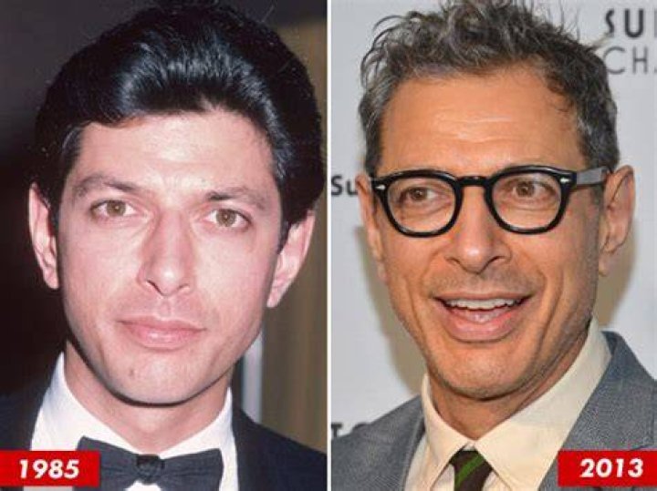 Jeff Goldblum's Plastic Surgery Journey: A Look At His Procedures And Results