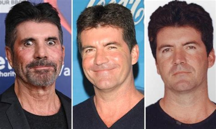Simon Cowell's Journey Through Malattia: A Closer Look At His Health Challenges