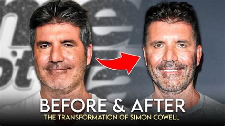 Simon Cowell's New Face: A Transformation To Remember