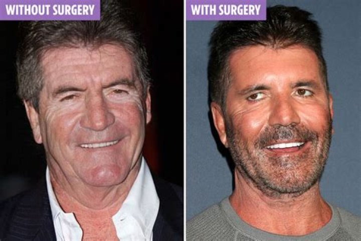 Simon Cowell: What Happened To Him?