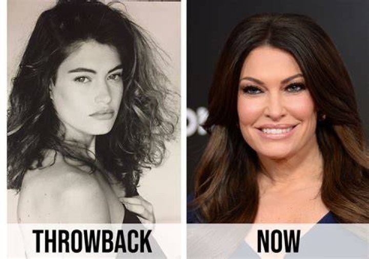 Transformative Journey: The Before And After Of Kimberly Guilfoyle