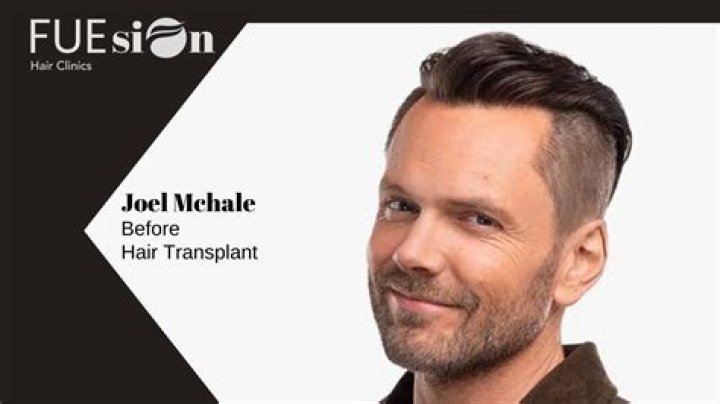 Unlocking The Style Secrets Of Joel McHale's Hair