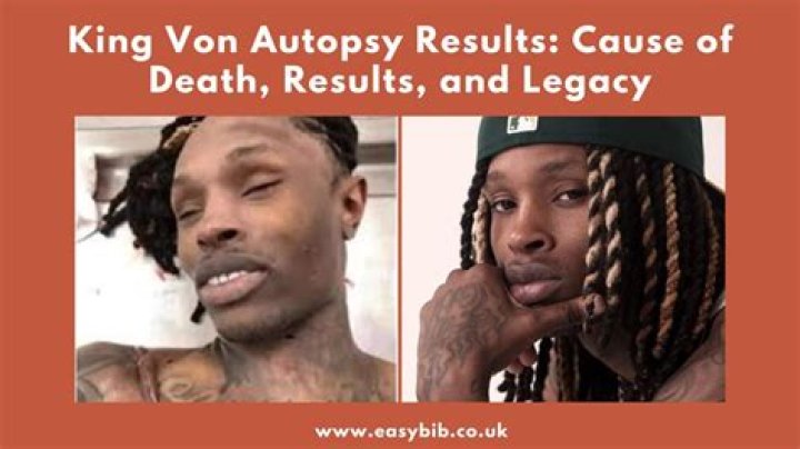 Unraveling The Mystery: King Von Autopsy Full