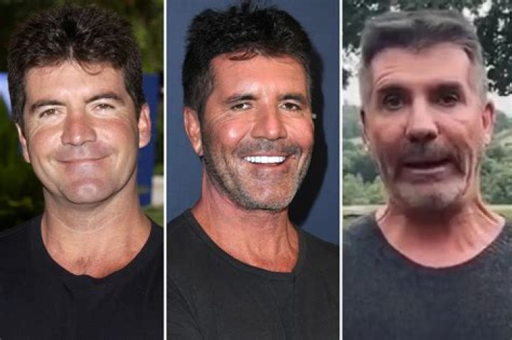 Unveiling The Mystery Behind Simon Cowell's Eyes