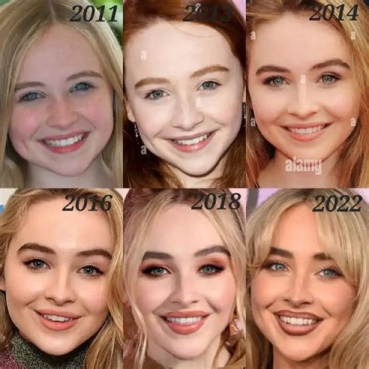 Unveiling The Transformation: Sabrina Carpenter’s Face Change