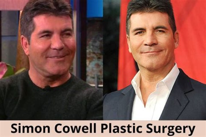 Unveiling The Truth Behind Simon Cowell's Plastic Surgery Video
