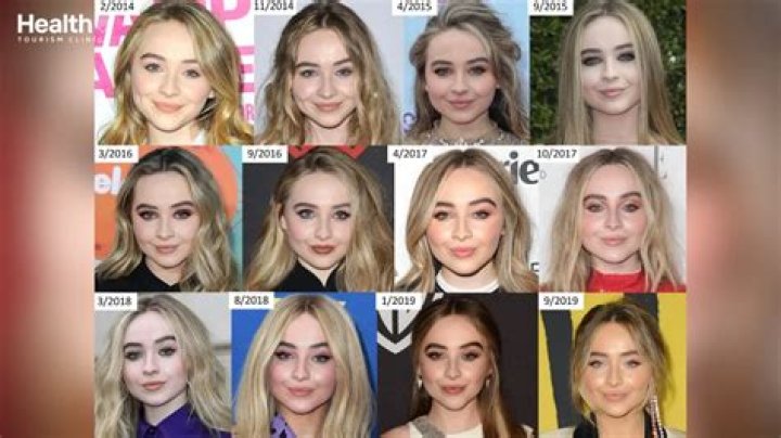 Unveiling The Truth: Did Sabrina Carpenter Get Lip Fillers?