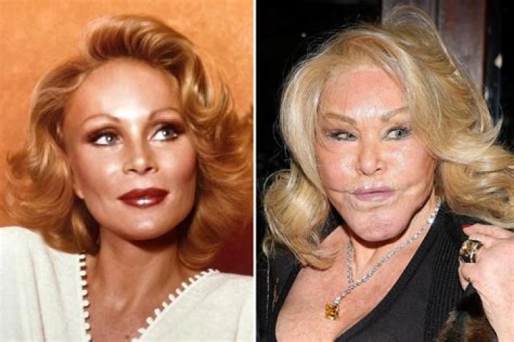 Unveiling The Truth: Has Garnacho Had Plastic Surgery?