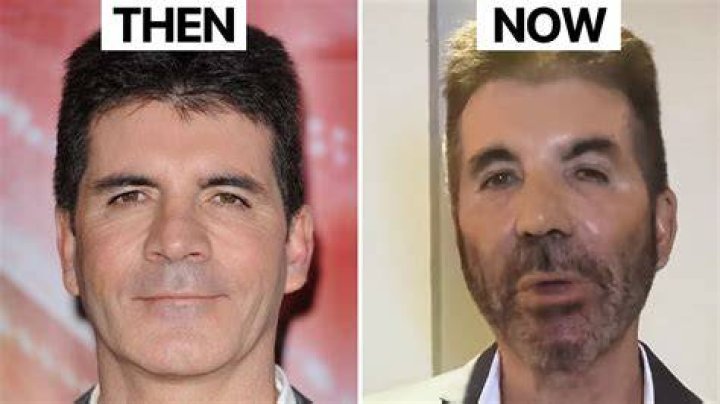 What Happened To Simon Cowell's Child's Health?